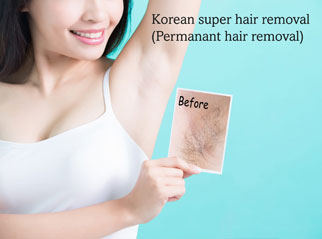 removal